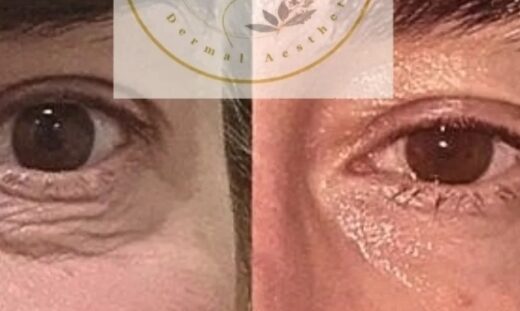 The.Dermal.Room by Dermal Aesthetics Vic